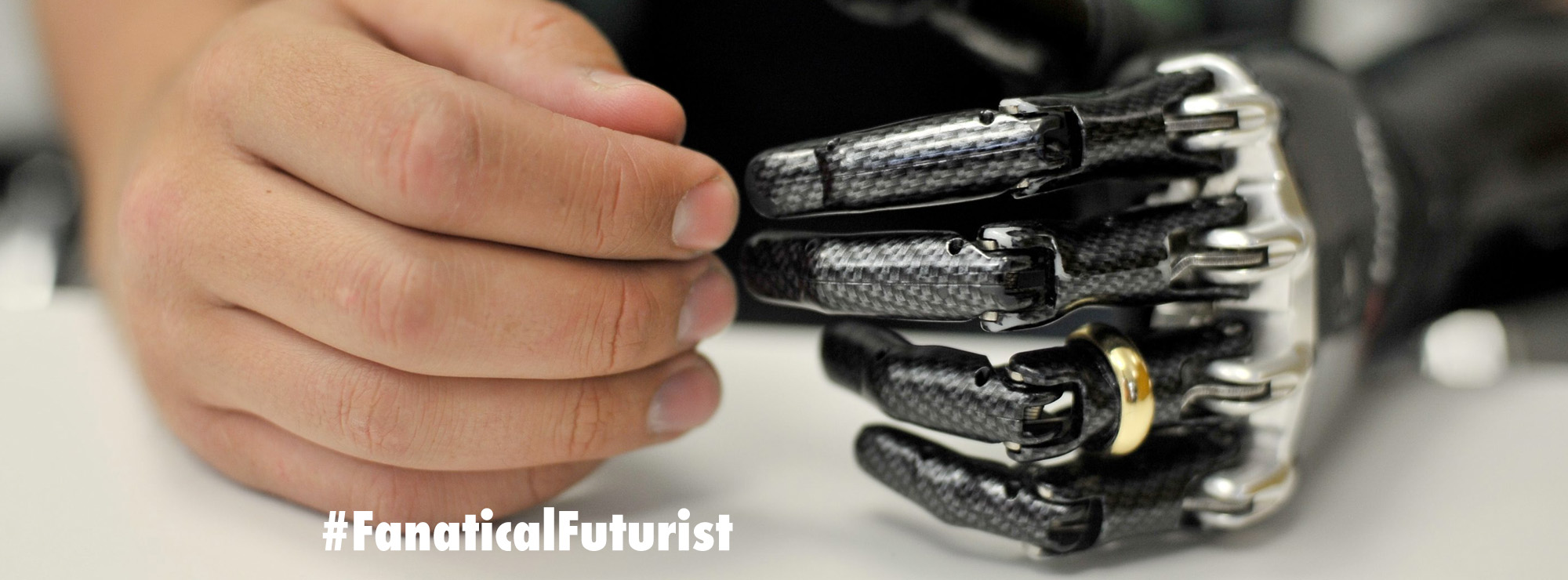 New prosthetic hand project will give amputees back their sense of touch By Futurist and Virtual Keynote Speaker Matthew Griffin