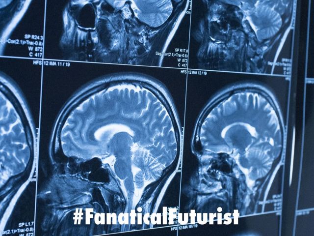 futurist_ai_iq