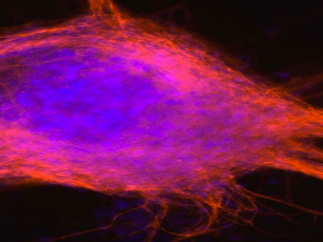 futurist_stem_cell_hiv