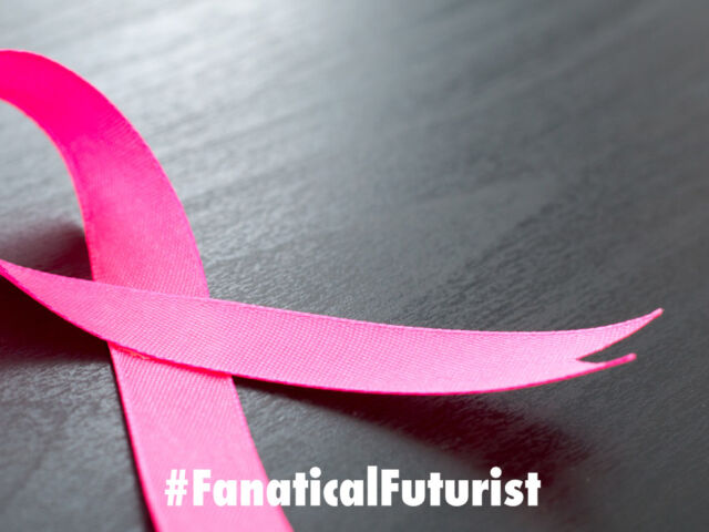 futurist_breast_cancer