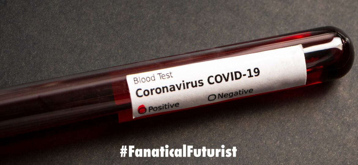 futurist_coronavirus_test