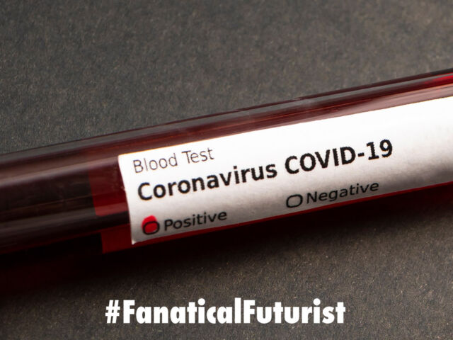 futurist_coronavirus_test