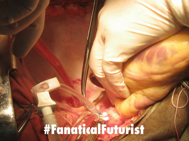 futurist_3d_in_vivo_printing