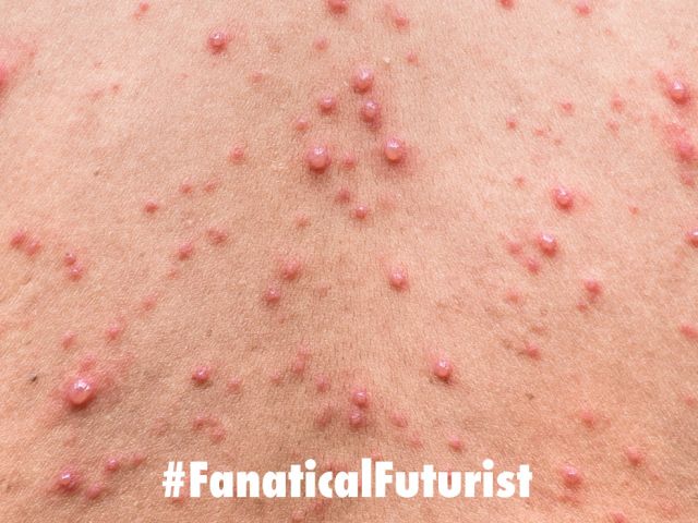 futurist_pox_virus_extinct_crispr