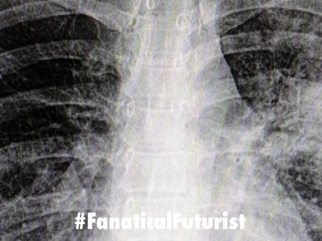 Futurist_xrays