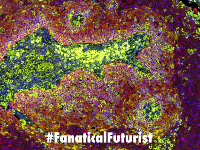 Futurist_cancerkiller