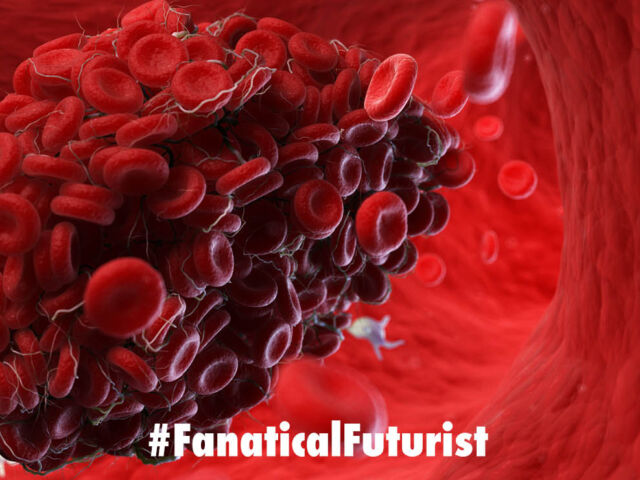 Futurist_bloodclot