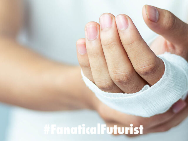 Futurist_diabeticwound