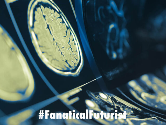 Futurist_cancerbrain