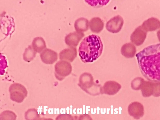 Futurist_sicklecell