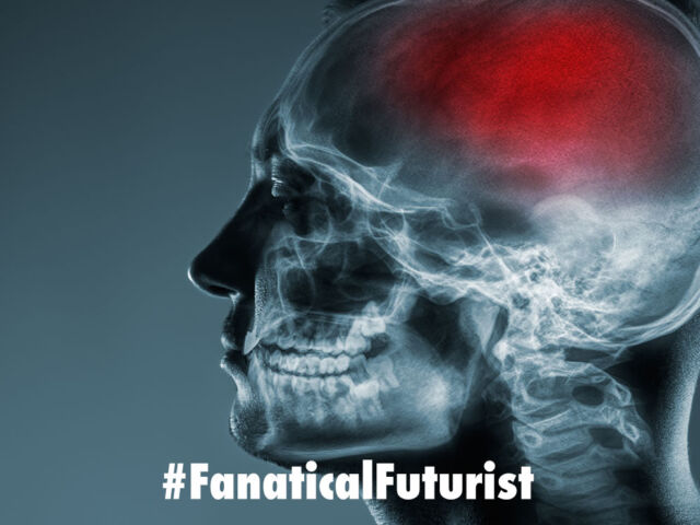 Futurist_strokeai