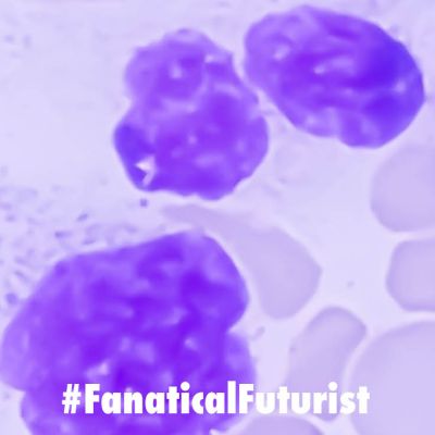 Futurist_cancercellsjpg