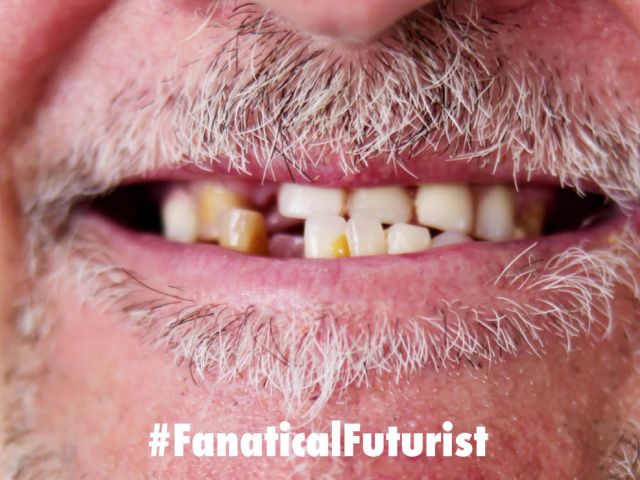 Futurist_teethregen