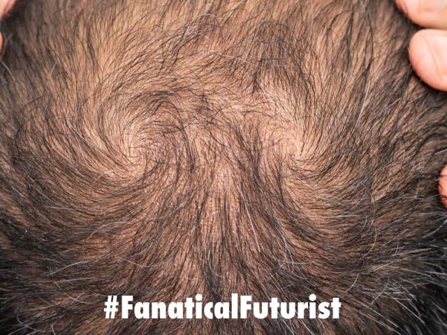 Futurist_tinybmi
